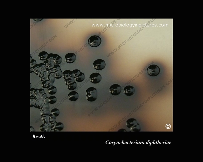 Closeup of Corynebacterium diphtheriae colonies with the cystinase activity and tellurite